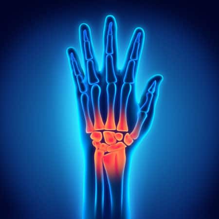 Best Wrist Surgery Doctor in Hyderabad